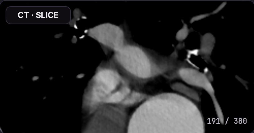 Axial CT slice preview in VenusX patient management