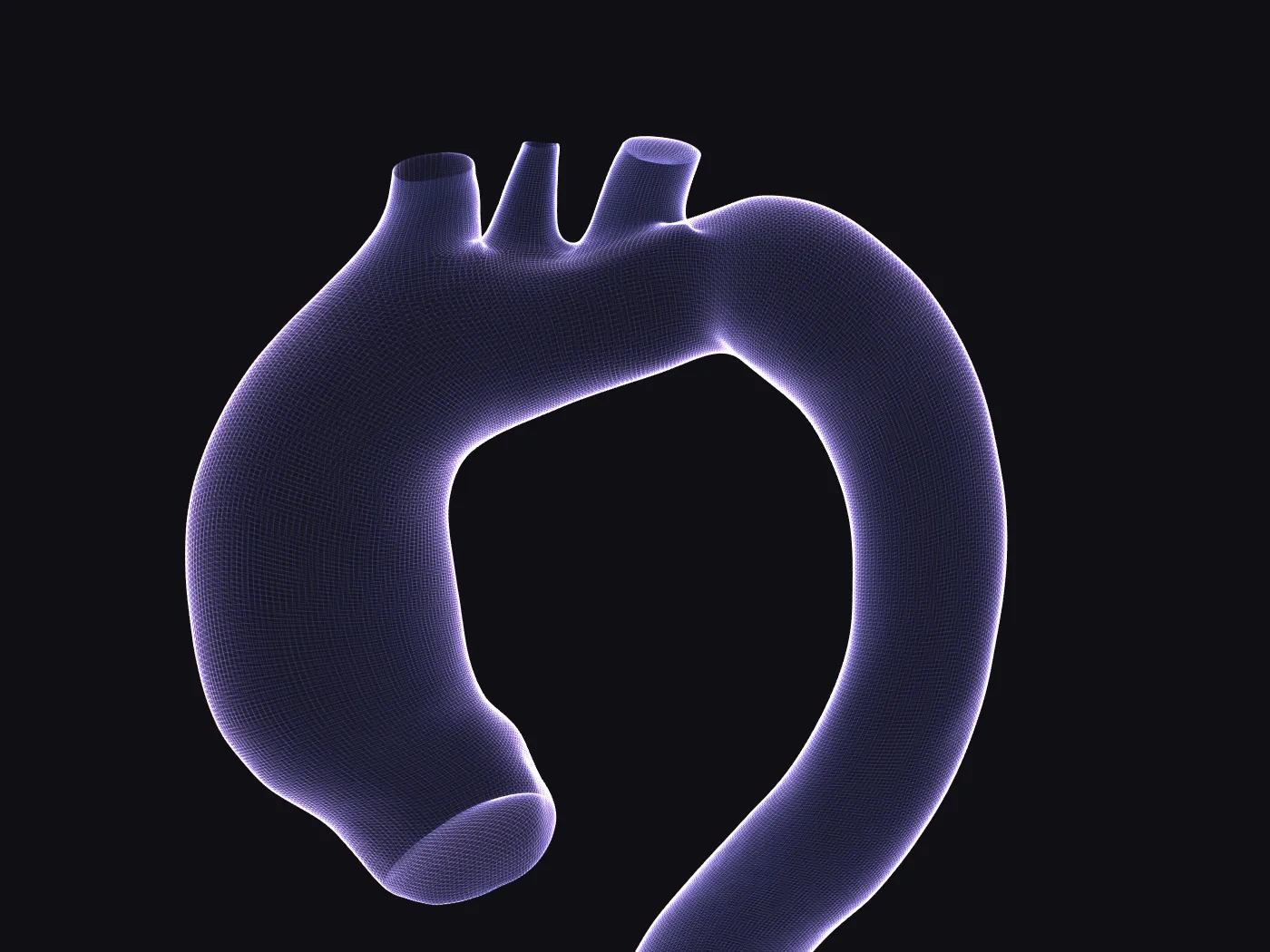 Computational mesh of a patient-specific vascular anatomy with its branches, rendered as a glowing wireframe