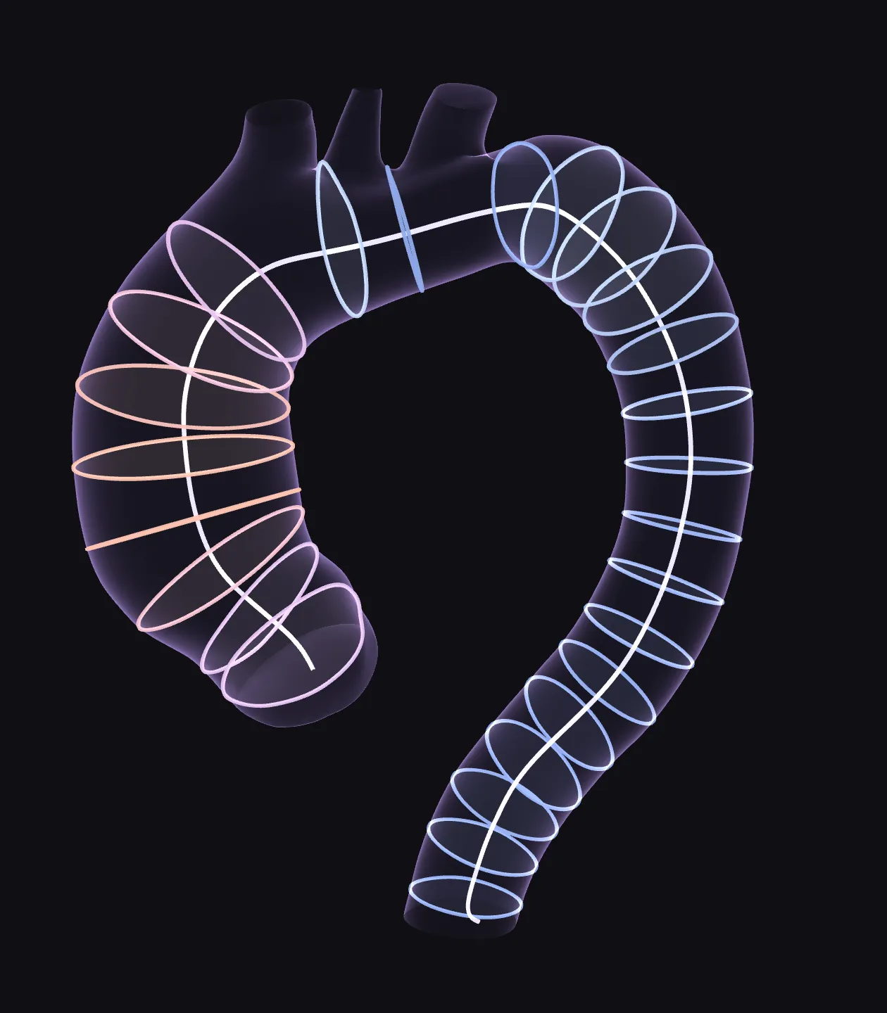Patient-specific aorta with its centerline and cross-sections perpendicular to it, each section coloured by its equivalent diameter