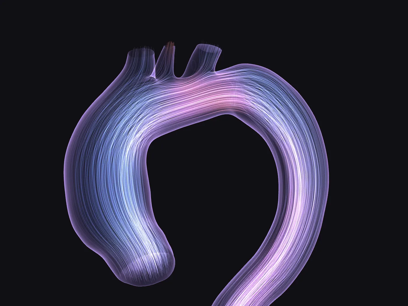 Simulated velocity streamlines in a patient-specific aortic arch at peak systole