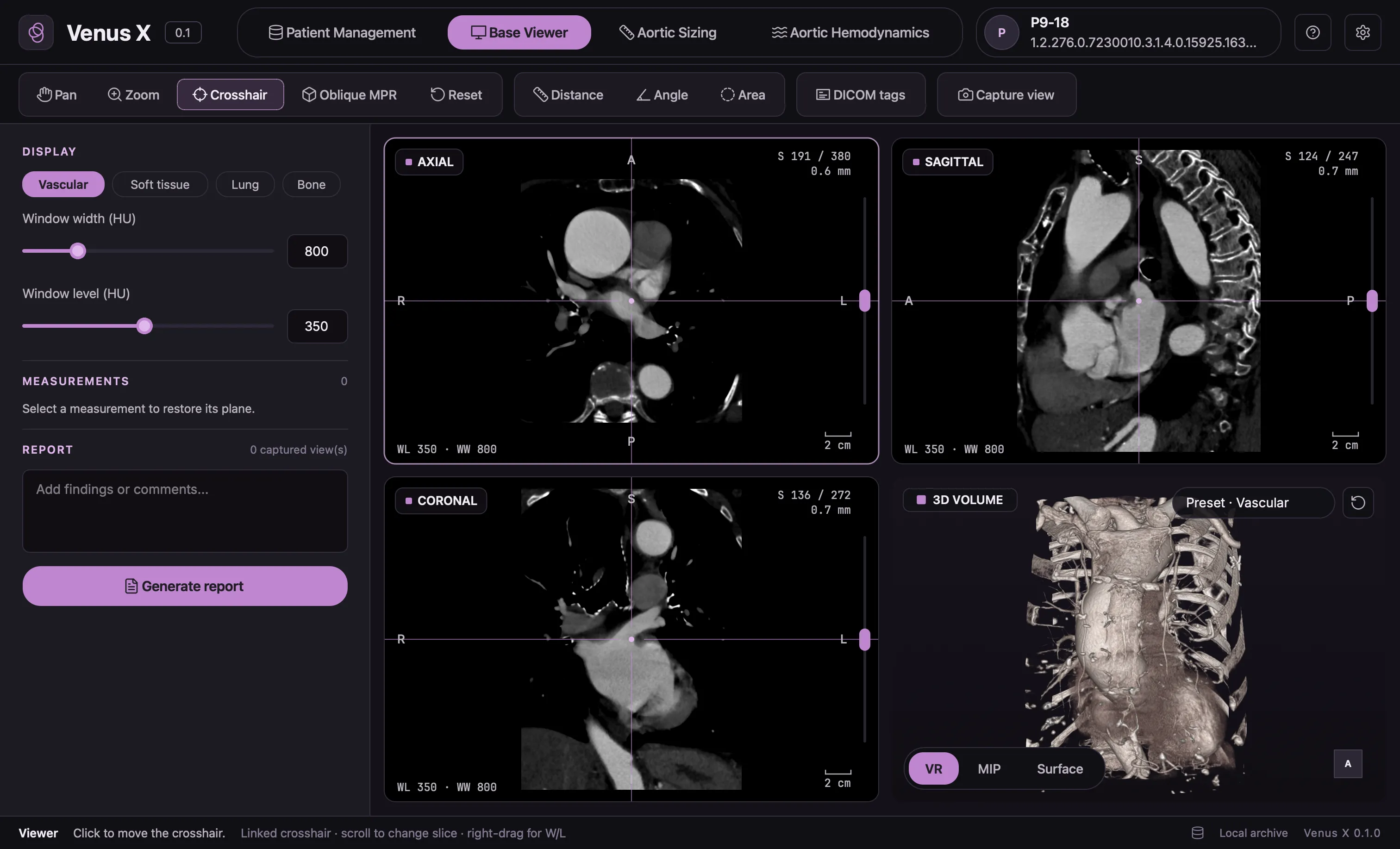 VenusX base viewer: axial, sagittal and coronal CT planes with a linked crosshair and a 3D volume rendering